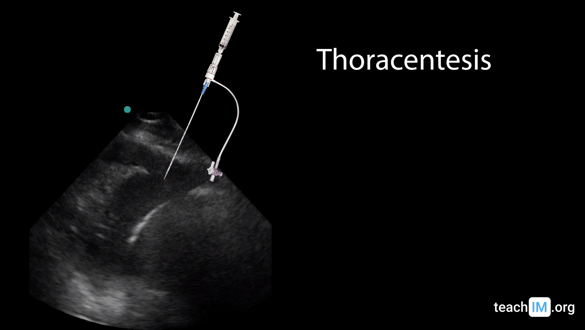 Thoracentesis Teaching Materials TeachIM Procedures Thoracentesis Teaching Materials TeachIM Procedures